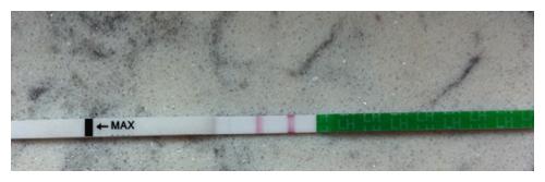 做完赠卵试管婴儿真的要小心吗-赠卵试管婴儿一定会成功吗？