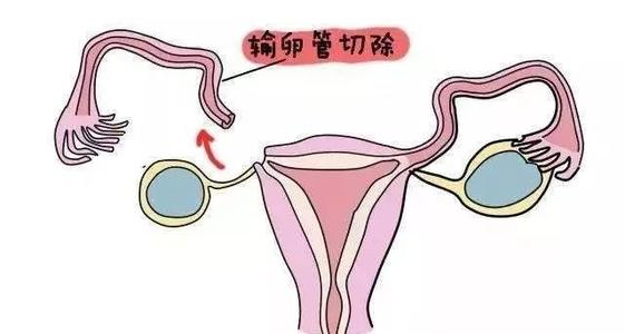 首先，了解供卵试管婴儿的二代和三代