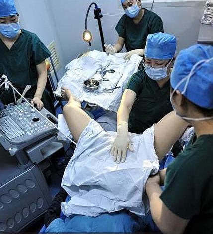供卵试管婴儿男方取精困难怎么办