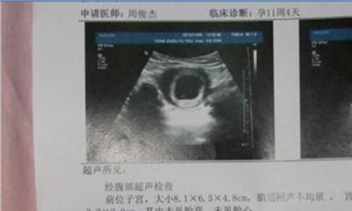 唐山市妇幼保健院生殖科怎么样，2022年做供卵代生试管供卵助孕成功率参考