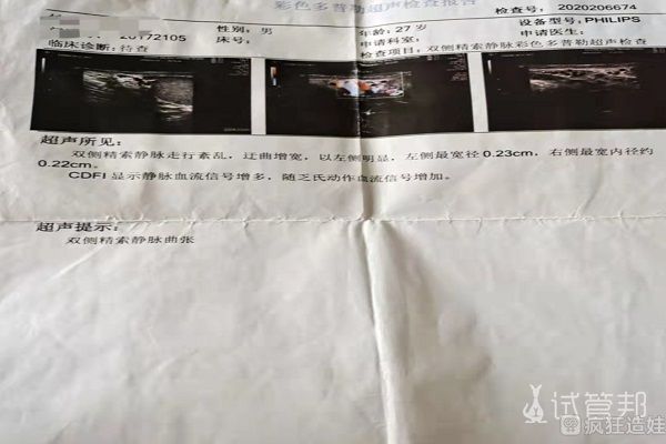 罗伯逊易位发生的原因是什么罗伯逊易位可以做三代做供卵试管吗