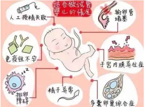 北京妇幼保健医院供卵试管婴儿那个试管医生好