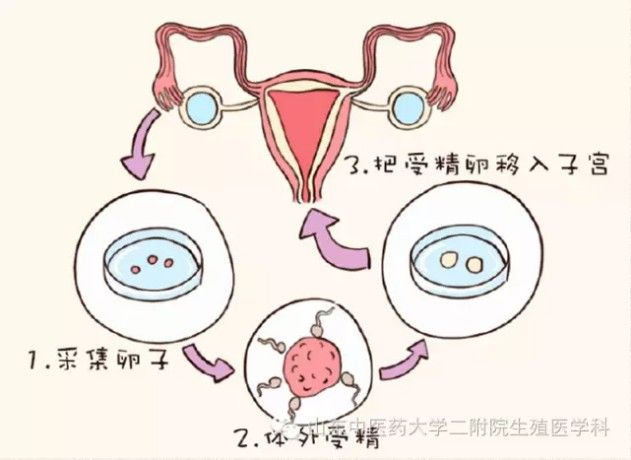 北京借卵做试管医院排行榜