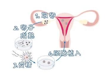 第三代试管哪家医院好
