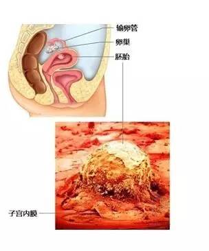 做试管取卵怎么取+做试管怎么取卵子
