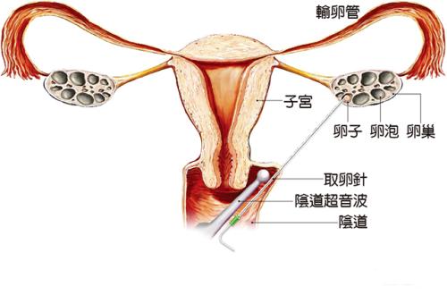 去中信湘雅试管要多久+中信湘雅供卵要等多久