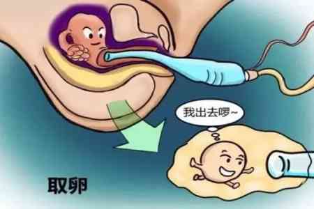 单身女性可以试管供精生小孩吗？医生道出了实情,劝你别忽视