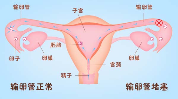 哪侧排卵容易生男孩（卵泡在哪边易生男孩右卵泡22×18）