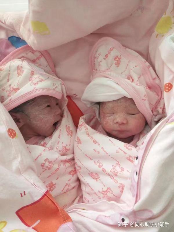 北京市省妇幼保健院试管成功率高吗