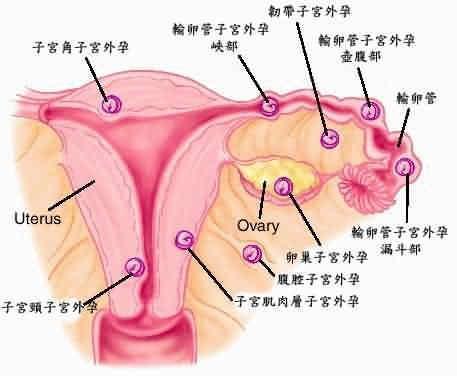 医院做试管代怀5个囊胚筛选成功率是多少