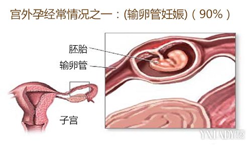 医院做试管代怀5个囊胚筛选成功率是多少