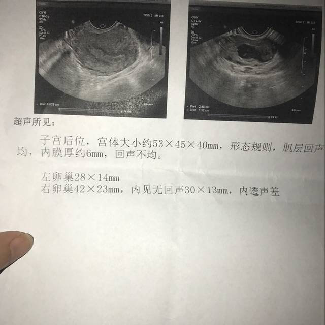 试管移植后出现腹胀怎么回事