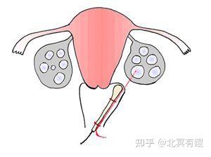 50岁哪里可以代生机构的成功率有多大,50岁试管代怀需要哪些条件成功率有多大试管移植后应该注意什么