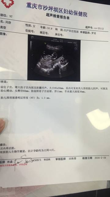 试管代怀生子助孕机构技术是如何收费的